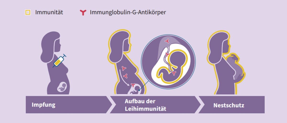 Verwunderlich Keuchhusten Impfung Schwangerschaft Erfahrungen Fotos